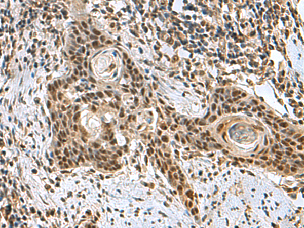 Rabbit Polyclonal Antibody to PRPF40A