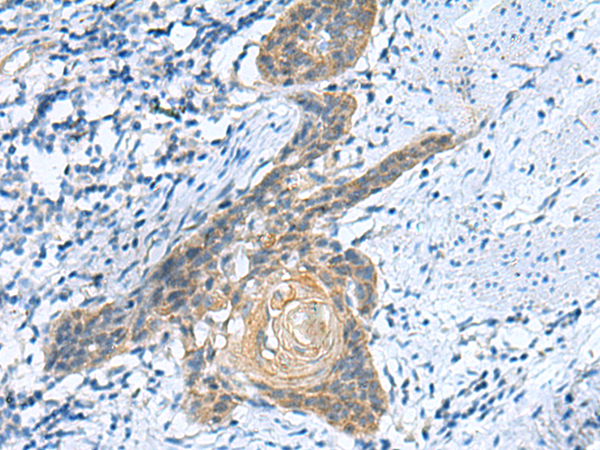 Rabbit Polyclonal Antibody to GINS3
