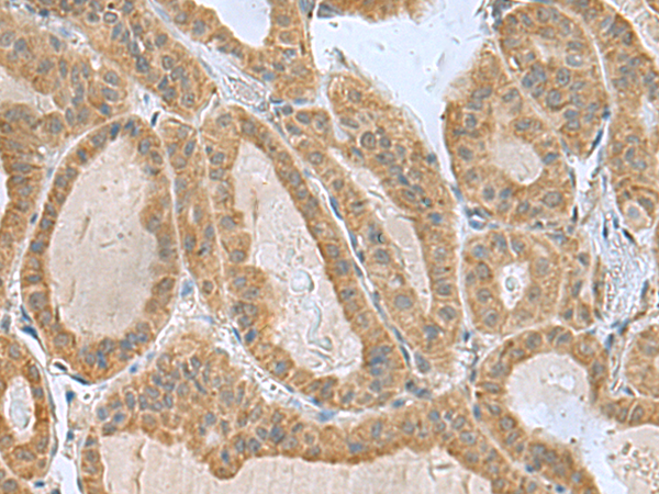 Rabbit Polyclonal Antibody to SLC30A6