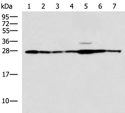 Rabbit Polyclonal Antibody to RPL10A