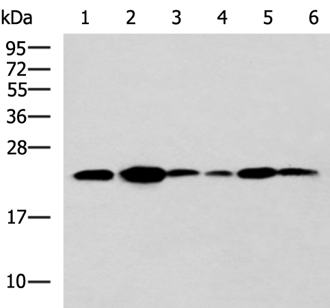 Rabbit Polyclonal Antibody to TMED10