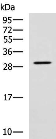Rabbit Polyclonal Antibody to LRAT