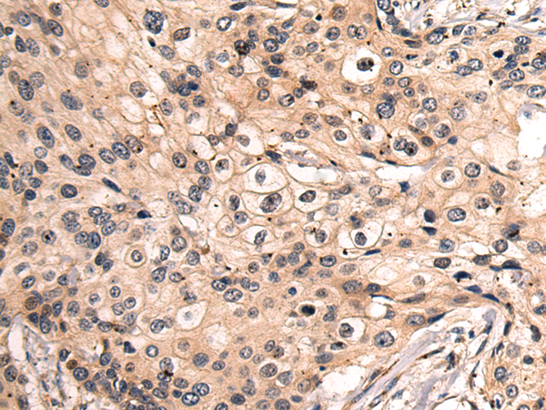 Rabbit Polyclonal Antibody to ITM2C