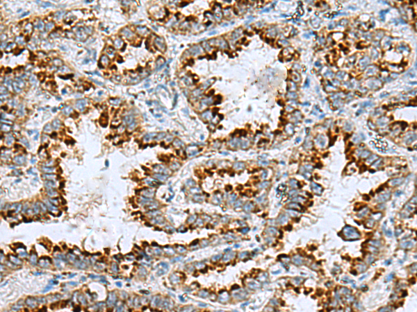 Rabbit Polyclonal Antibody to FAAP100