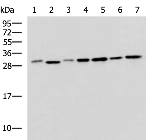 Rabbit Polyclonal Antibody to EXOSC4