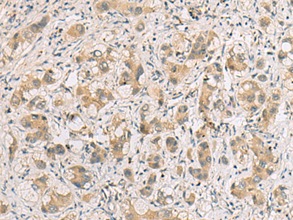 Rabbit Polyclonal Antibody to RTP4