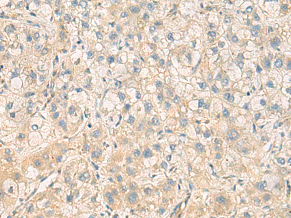 Rabbit Polyclonal Antibody to PPM1M