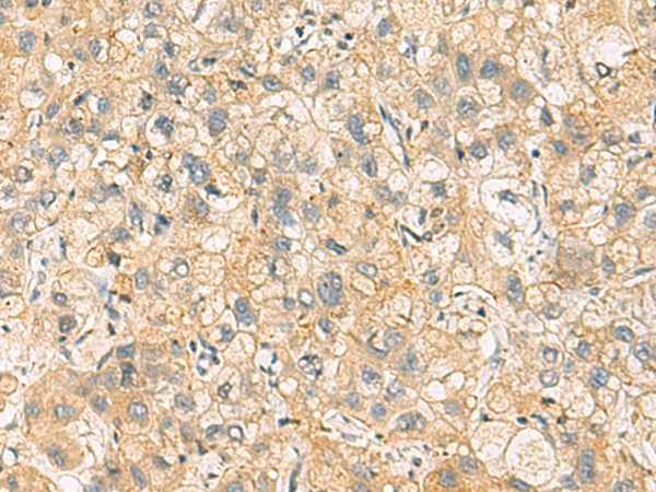 Rabbit Polyclonal Antibody to NANP