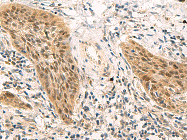 Rabbit Polyclonal Antibody to PSME1