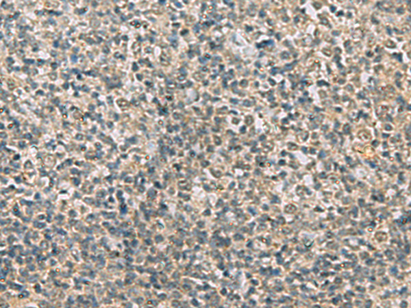 Rabbit Polyclonal Antibody to RAB3IP