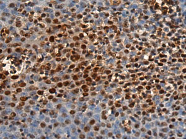 Rabbit Polyclonal Antibody to PSME3