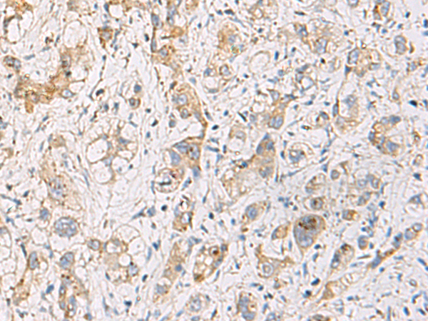 Rabbit Polyclonal Antibody to FYCO1