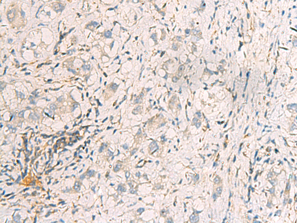 Rabbit Polyclonal Antibody to SUSD3