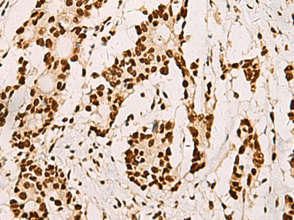 Rabbit Polyclonal Antibody to ELF5