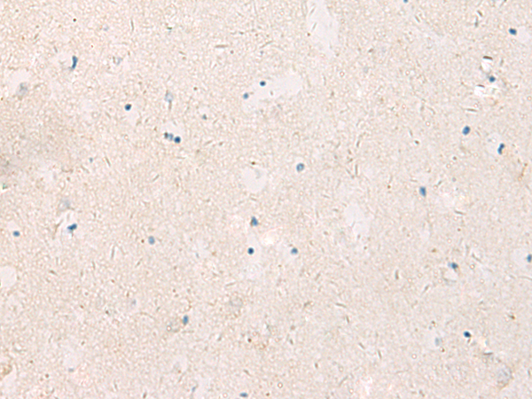 Rabbit Polyclonal Antibody to KCNIP3