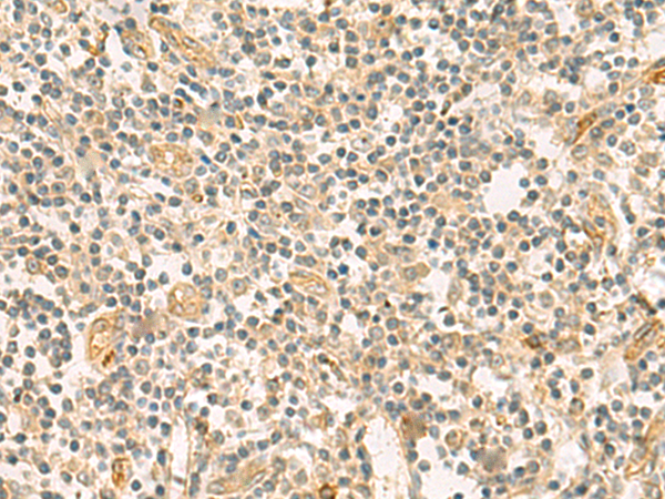 Rabbit Polyclonal Antibody to HHIPL2