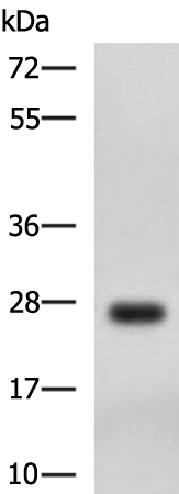 Rabbit Polyclonal Antibody to DHRS2
