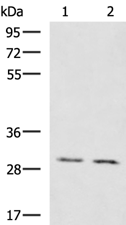 Rabbit Polyclonal Antibody to KRCC1