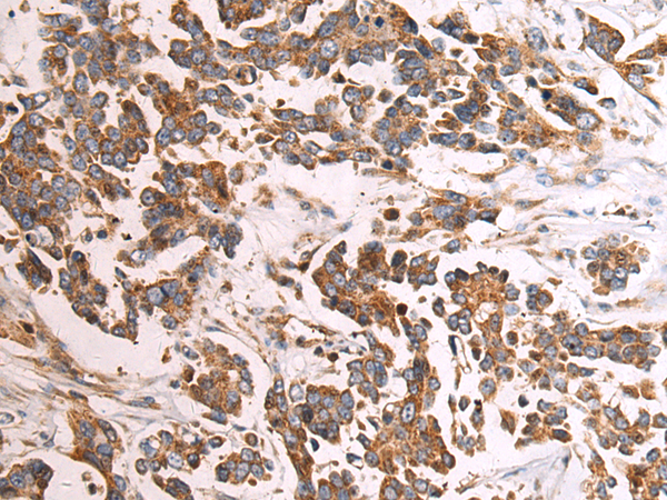 Rabbit Polyclonal Antibody to KCTD4