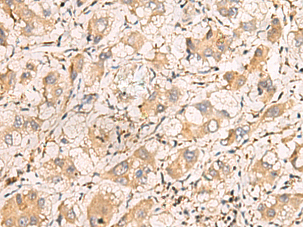 Rabbit Polyclonal Antibody to TNNT1