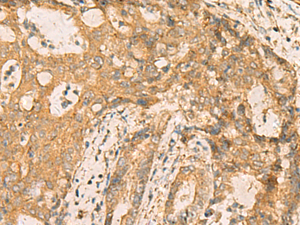 Rabbit Polyclonal Antibody to CNST