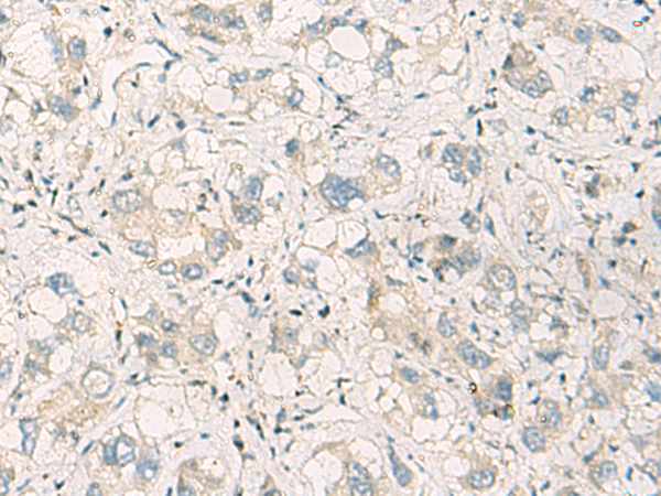 Rabbit Polyclonal Antibody to SPSB2