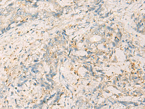Rabbit Polyclonal Antibody to WDR37