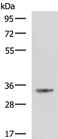 Rabbit Polyclonal Antibody to C11orf54