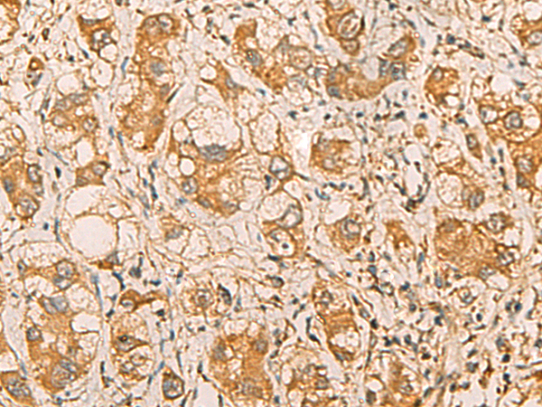 Rabbit Polyclonal Antibody to MRPL9