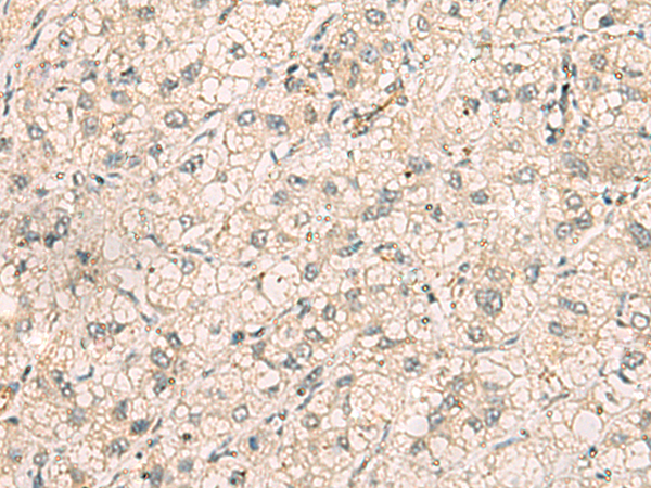 Rabbit Polyclonal Antibody to TTLL5