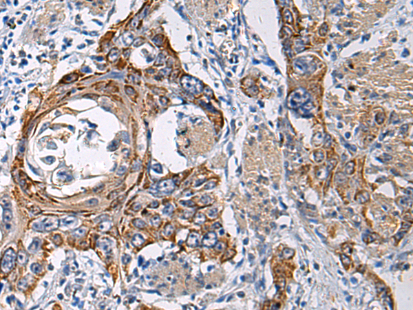 Rabbit Polyclonal Antibody to RITA1