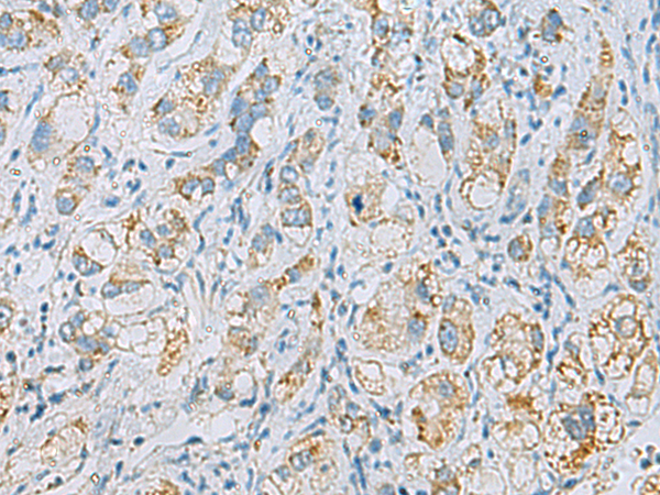 Rabbit Polyclonal Antibody to PLA2G15