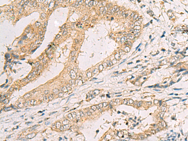 Rabbit Polyclonal Antibody to SPACA1