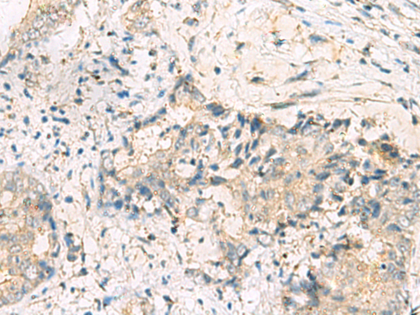 Rabbit Polyclonal Antibody to MGAT4B