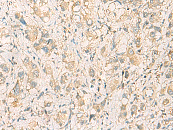 Rabbit Polyclonal Antibody to F11R