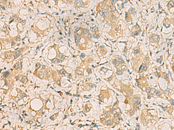 Rabbit Polyclonal Antibody to ZDHHC3
