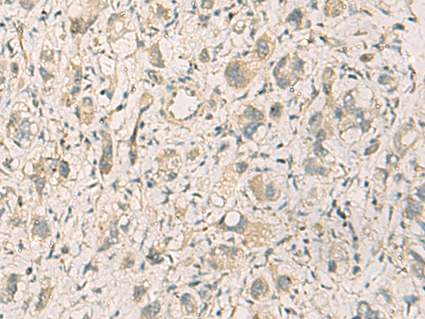 Rabbit Polyclonal Antibody to PDCL