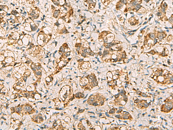Rabbit Polyclonal Antibody to VTA1