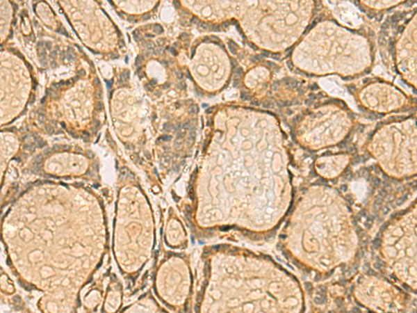 Rabbit Polyclonal Antibody to HORMAD2