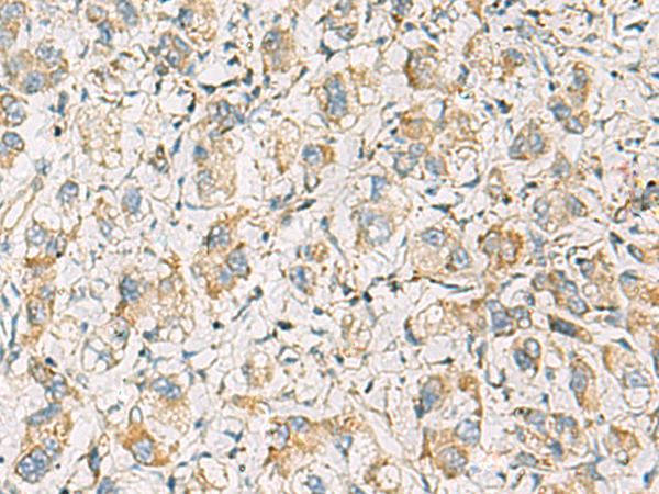 Rabbit Polyclonal Antibody to PDE4DIP