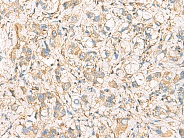 Rabbit Polyclonal Antibody to IDS