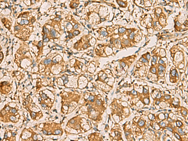 Rabbit Polyclonal Antibody to AIMP1