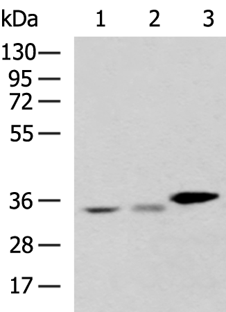 Rabbit Polyclonal Antibody to PDXK