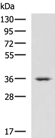 Rabbit Polyclonal Antibody to CRYM