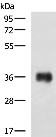 Rabbit Polyclonal Antibody to EPCAM