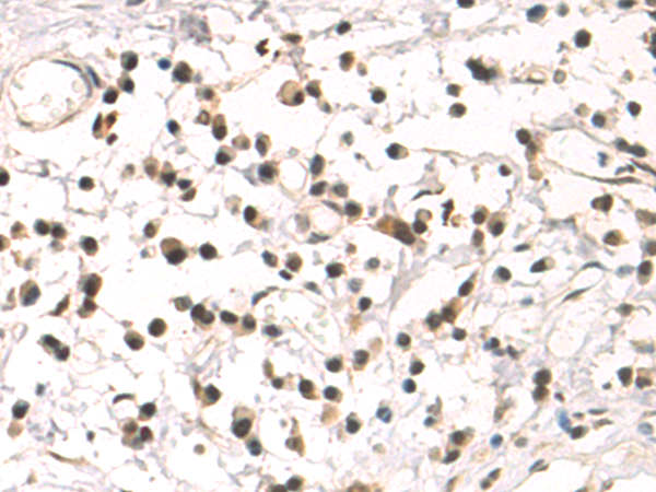 Rabbit Polyclonal Antibody to NFYA