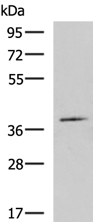 Rabbit Polyclonal Antibody to FBXO8