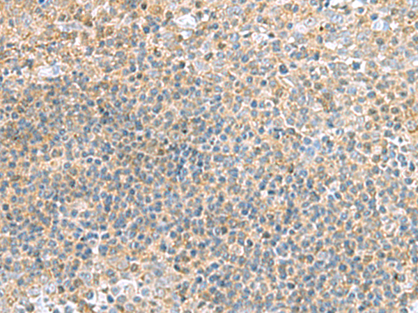 Rabbit Polyclonal Antibody to TSTA3
