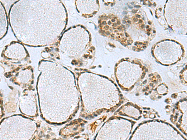 Rabbit Polyclonal Antibody to PTPA