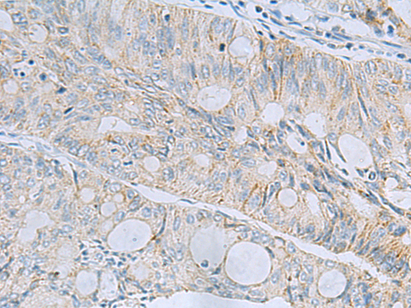 Rabbit Polyclonal Antibody to MSI2